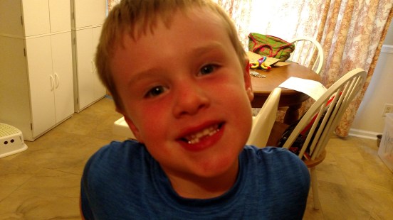 IMG_20170510_190358379